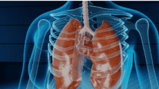 Los 10 alimentos que fortalecen tus pulmones y que no sabías que necesitabas. Foto Pixabay